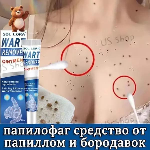 Премиальное средство против бородавок, папиллом и кондилом, используемое для удаления ороговевшей кожи, 20 г в эксклюзивном исполнении- LCY