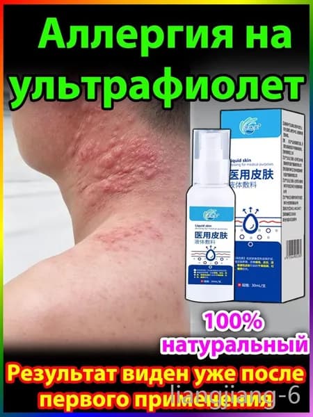 Крем для лечения солнечного дерматита,Восстановление кожи после солнечных ожогов крем после загара