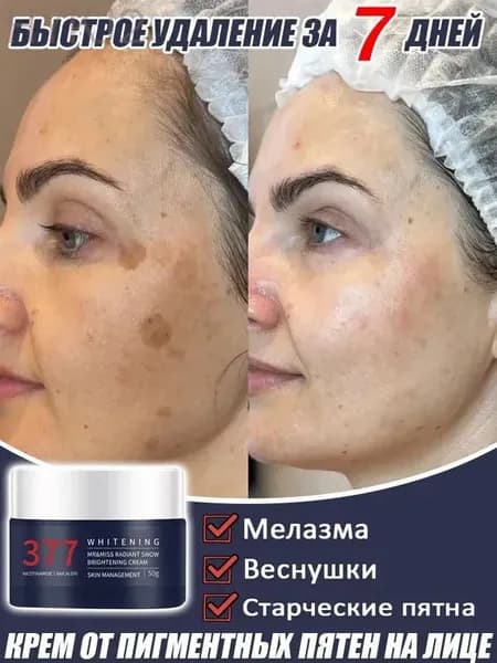 Крем от пигментных пятен на лице, 50 г ,осветляет веснушки, старческие и пигментные пятна на лице.