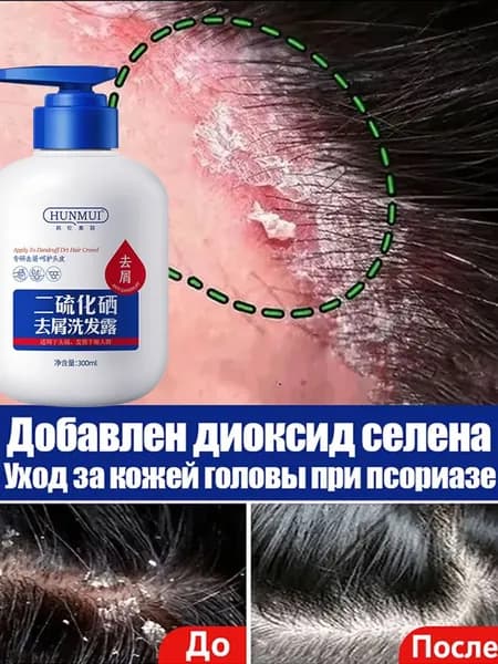 Шампунь для волос, 303 мл