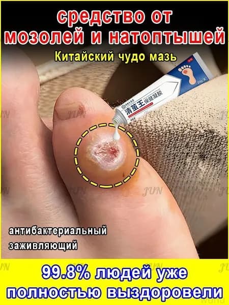 Средство для удаления натоптышей
