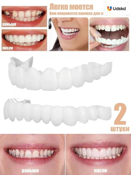 Уникальный протез для взрослых Perfect Smile с защелкивающимся креплением