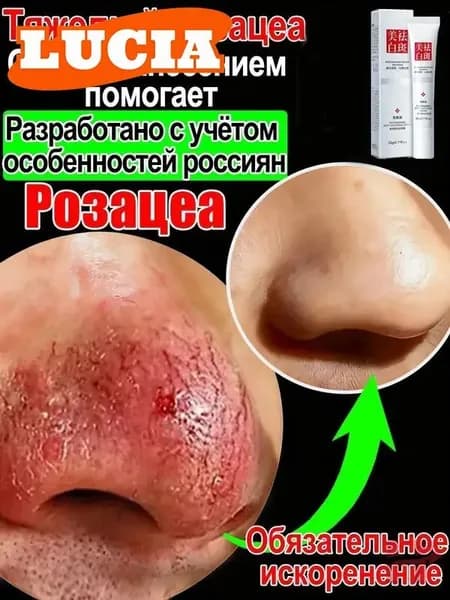 Крем от купероза для лица покраснений на лице и розацеа,Куперофаг Крем от купероза на лице, антикупероз, сред