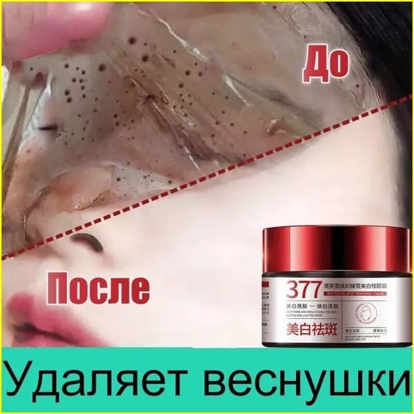 Крем для лица от Веснушек и Пигментных пятен 30г против пигментации, отбеливающий увлажняющий, Содержит гиалуроновую кислоту и 377.