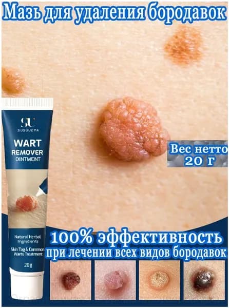 SUSUVETA крем от бородавок и папиллом, средство для удаления сухих мозолей и натоптышей, уход за кожей рук и ног, 20 г
