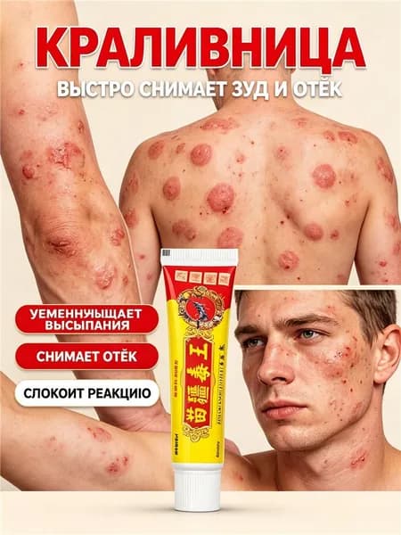 Быстро снимает зуд и отек, уменьшает сыпь и успокаивает кожные реакции. Неотложная помощь при аллергической крапивнице и кожных высыпаниях