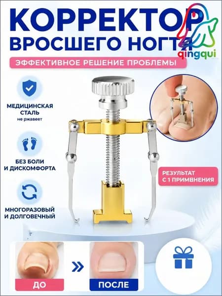 Коррекция вросших ногтей
