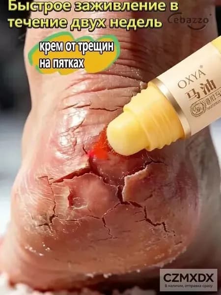 Крем воск от трещин для очень сухой кожи, крем для ног с мочевиной 5%, от трещин на пятках, воск для пяток