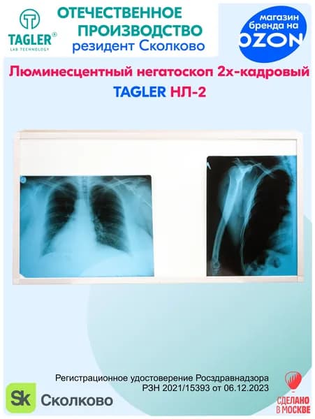 Негатоскоп двухкадровый люминесцентный Таглер НЛ-2 (с Регистрационным Удостоверением)