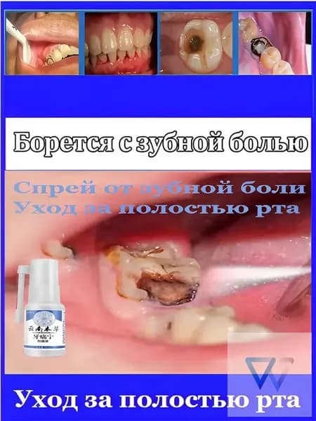 Спрей от зубной боли, лечит зубную боль, быстро снимает боль