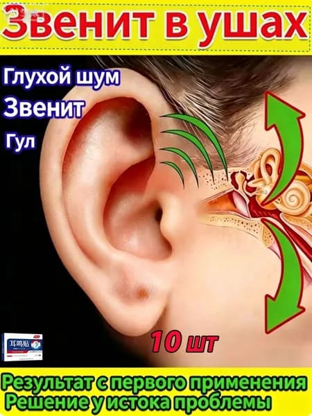 Средство от шума в ушах при звоне в ушах, пластыри из натуральных трав снимают дискомфорт, улучшают слух, 10 шт