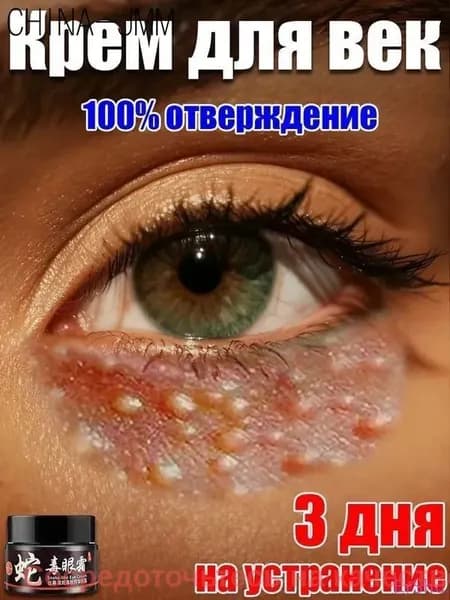 средство от милиумов на лице, ретидерм крем для век антивозрастной, натуральный удаления липомы Быстро удаляет подкожную липому, показан при отечности кожи,целлюлите,фиброзном жировике