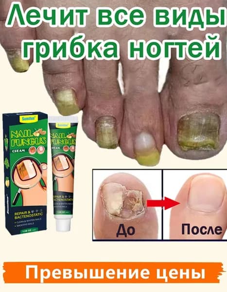 Мазь от грибка ногтей на ногах 30 г,противогрибковое средство, Алтея,крем для ног, от трещин, для пяток, стоп онихолизис