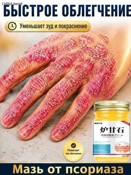 Негормональная мазь от псориаза, экземы, нейродермита и грибковых заболеваний, китайский крем от псориаза, 50 г.