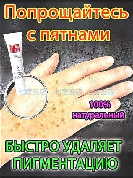 Отбеливающий крем от веснушек и солнечных пятен, подходит для удаления и исчезновения желтых пятен и старчес