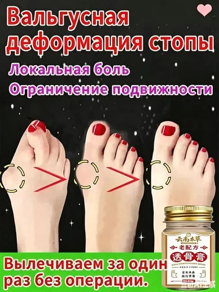 Легендарный тайский крем от косточки на ноге