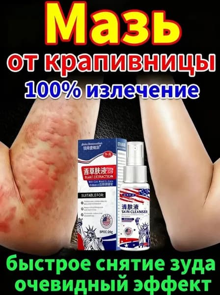 Мазь от крапивницы, Используется для лечения симптомов дерматита, крапивницы, экземы, зуда кожи, китайская чудо-мазь, 20 г.