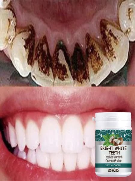 KSYOKS Зубной порошок "Bright White Teeth": яркое беление зубов + освещение дыхания (кокосовый+мятный вкус) приятный натуральный уход за улыбкой
