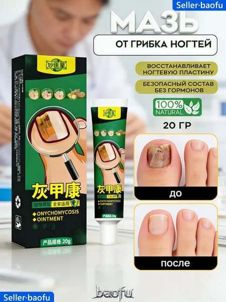 Средство от грибка ногтей на ногах и руках, масло от грибка ногтей на ногах, Стоп онихолизис, 20 мл, Продукция косметическая гигиеническая.