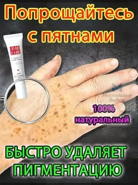 Отбеливающий крем от веснушек и солнечных пятен, подходит для удаления и исчезновения желтых пятен и старчес