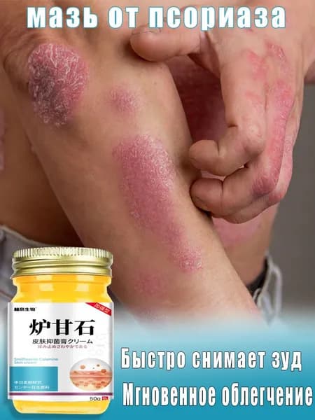 SUSUVETA мазь от псориаза, 50 г