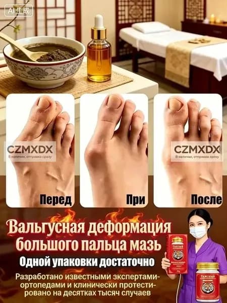 Крем при вальгусной деформации, от шишек на больших пальцах ног,55 мл/Быстродействующие обезболивающие