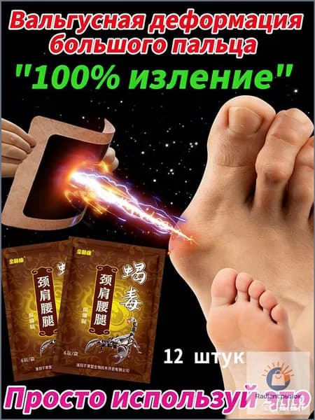 пластырь от косточки на большом пальце Облегчите боль в ногах и улучшите выпячивание суставов