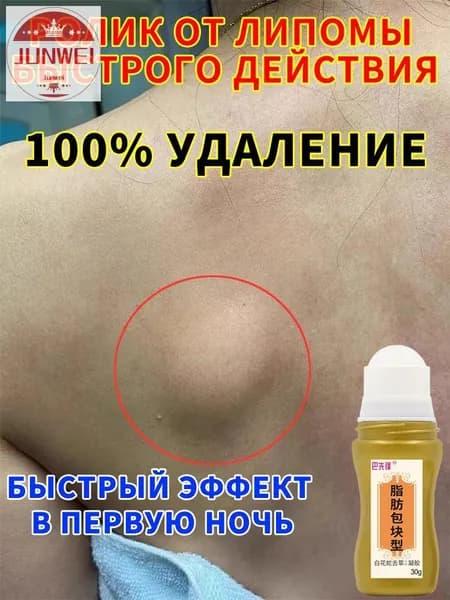 Крем-мазь от жировиков и липомы 30 г Против уплотнений кожи, уход для проблемных зон