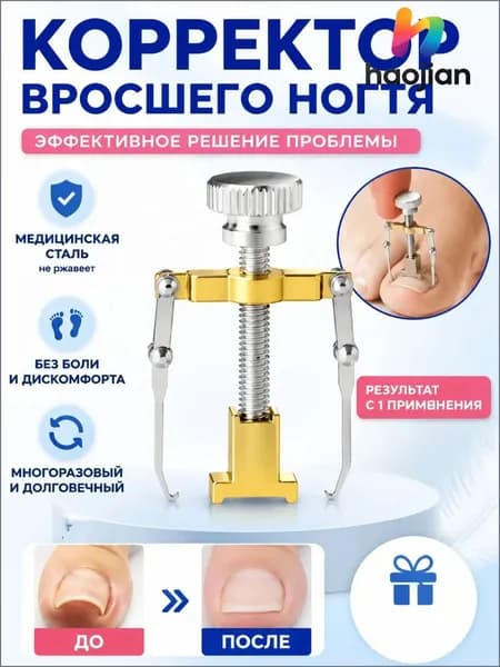Коррекция вросших ногтей