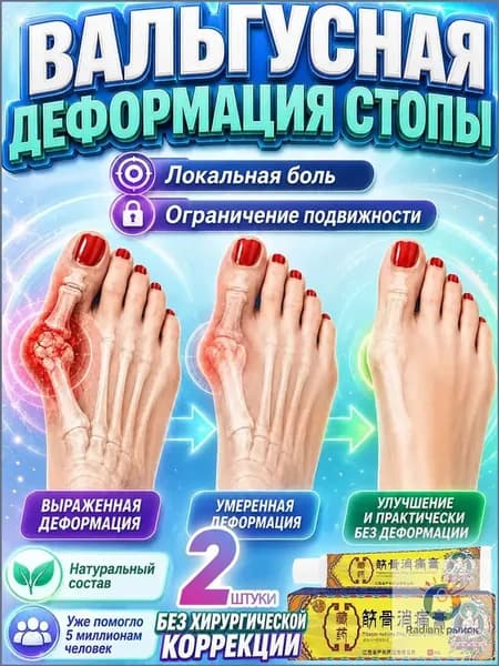 2 штуки,мазь от косточки на большом пальце,тайская от подагры мазь,монастырская от шишки