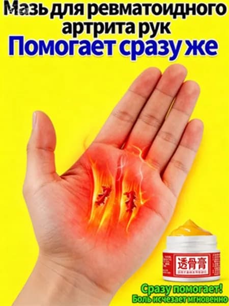 Анальгетики для спины, поясницы и суставов, мази от болей в теле и мышцах, противоотечные и успокаивающие средства для связок