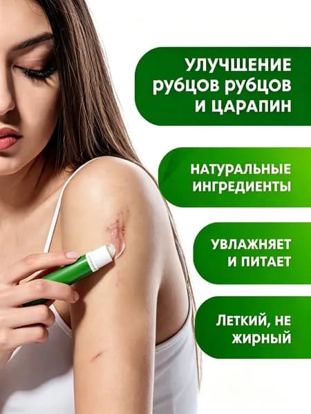 Усовершенствованный гель для ухода за рубцами и келоидами, силиконовый гель для восстановления, смягчает рубцы на лице, ушах и всем теле