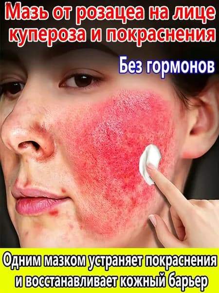 Антикуперозный крем для лица от купероза и розацеа, успокаивающий крем против покраснений для чувствительной кожи, увлажняющий и восстанавливающий, 20 г