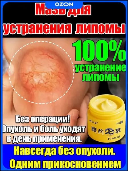 Мазь от липомы и жировиков 20 г Лечебный уход