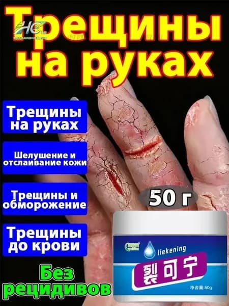 Китайская мазь от трещин на руках: натуральный состав и быстрое действие.