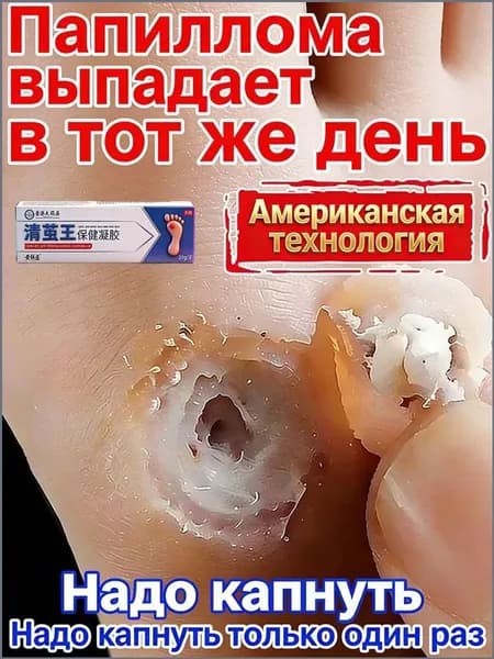 Мазь гарантированно избавляет от трещин, мозолей и натоптышей на пятках, быстро смягчает огрубевшую кожу и восстанавливает гладкость стоп