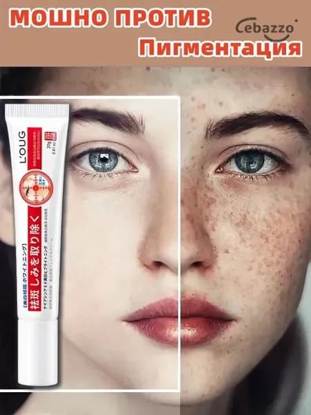 Антивозрастной крем для лица от пигментных пятен с SPF, ниацинамидом и центеллой, против морщин и веснушек, осветляющий уход для лица и тела 20г