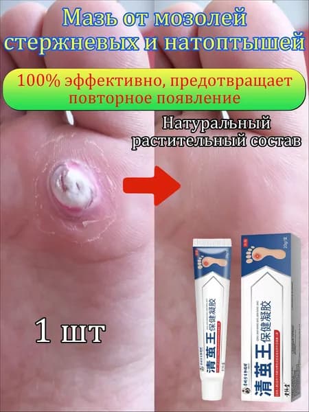 Mазь от мозолей стержневых и натоптышей ,Крем от сухих мозолей, шипицы, бородавок, натоптышей,20 г 1 шт.