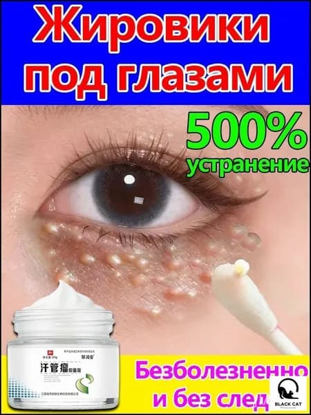 Удаление милиумов под глазами и на веках Быстрое избавление от жировых гранул. Мазь/крем для лечения