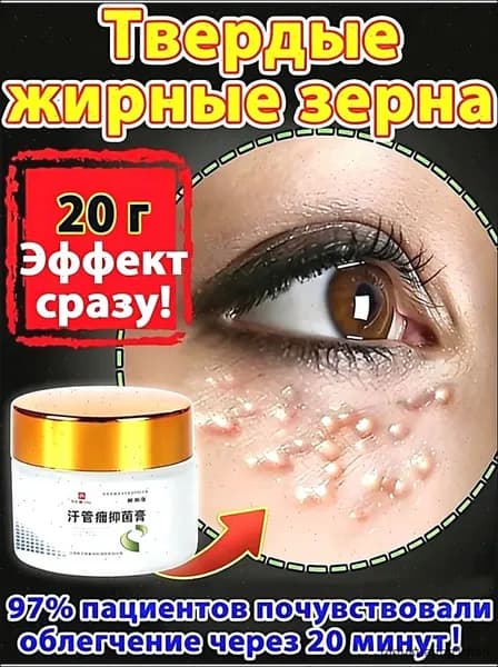 Крем от жировиков милиумов от просянки белых угрей 20 г/банка