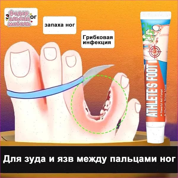 Средство от запаха ног для зуда и язв между пальцами, против грибка, дезодорант эффективное 20г