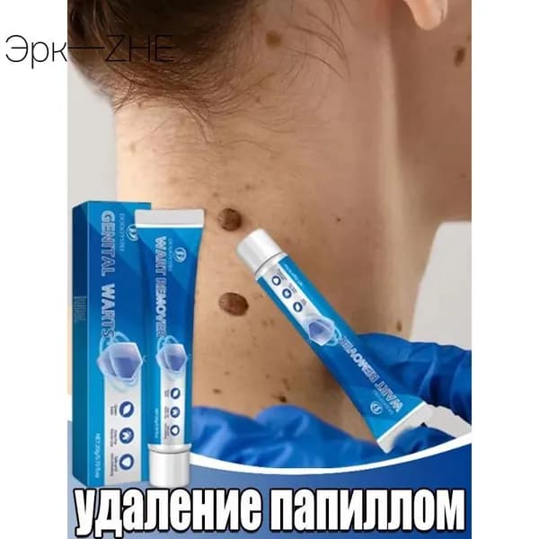 LUKAOHUA / Мазь от бородавок, Крем средство для удаления бородавок, папиллом и родинок, безболезненно, не оставляет следов без побочных эффектов / 20г