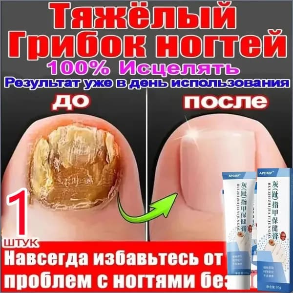 Крем от грибка ногтей, средство для восстановления поврежденных ногтей рук и ног, 1 шт