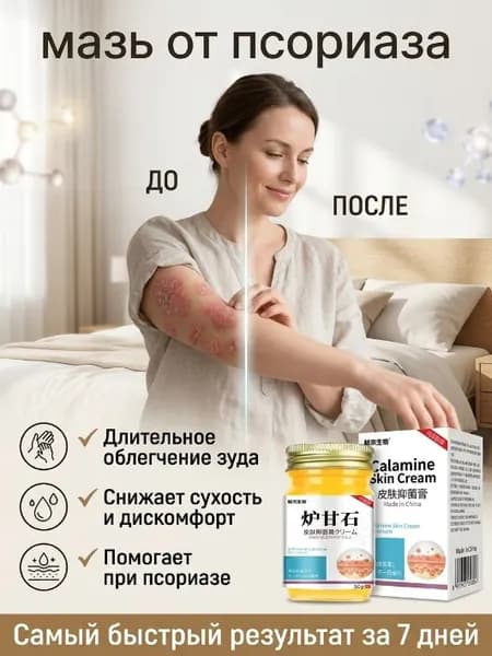 псорифенак мазь от псориаза, мазь при кожных заболеваниях. Гель от акне, экземы, дерматита, грибка, герпеса, угрей, сыпи и покраснений 50 гр.