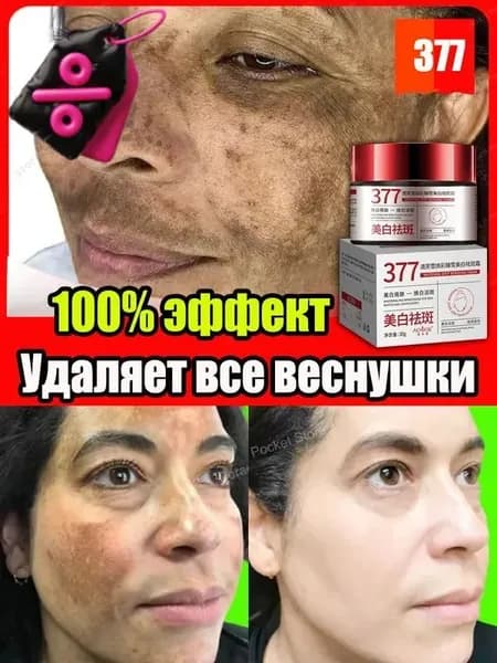 377 Отбеливающий крем от веснушек, пигментных пятен, 30 гр, эффективно борется со стойкими темными пятнами, осветляющий