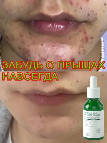 Сыворотка для ухода за кожей Сужение пор, 30 мл