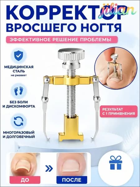 Коррекция вросших ногтей