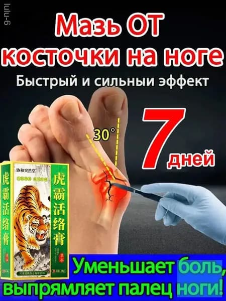 Мазь от вальгусной деформации стопы/20 мл, специальная для лечения воспаленных костей стопы