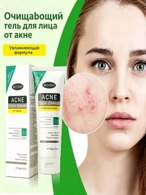Мягкое очищающее средство для умывания против акне, увлажняющее кожу, 100 г, 1 шт.