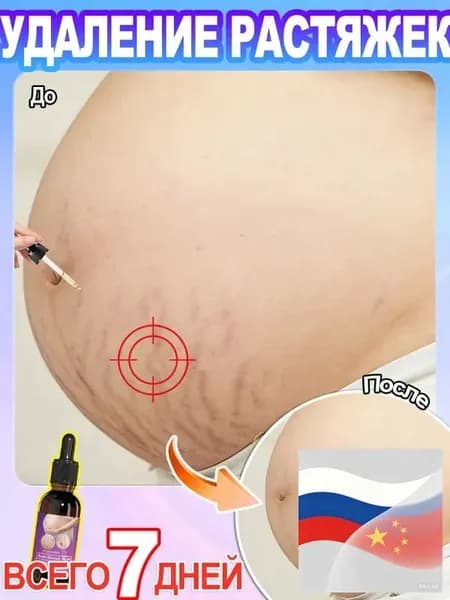 Эссенция от растяжекС коллагеном, эластином и маслом какао. Профилактика и коррекция стрий на животе и бедрах. Гипоаллергенно.1 бутылка